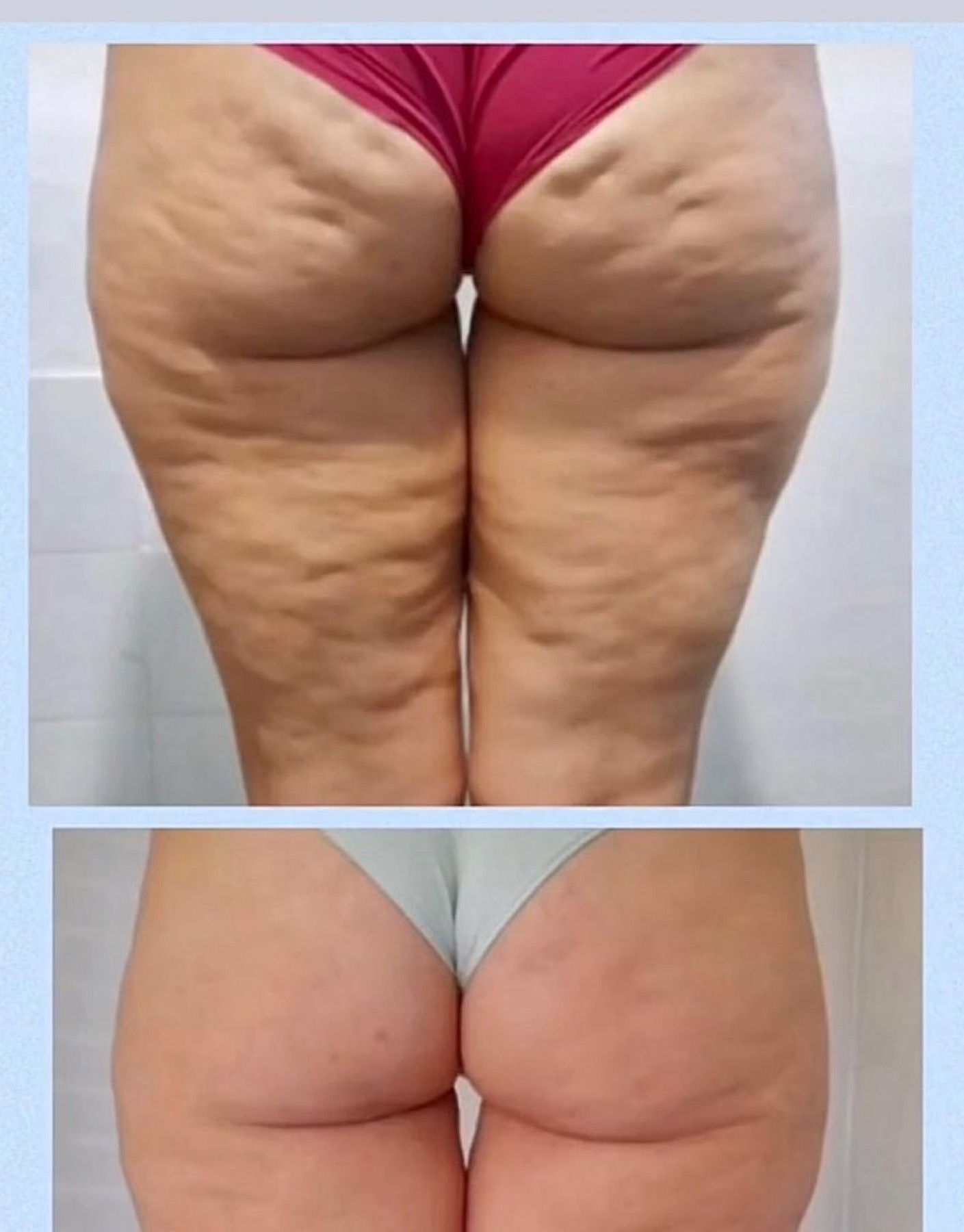 Liposana 3 6er Paket